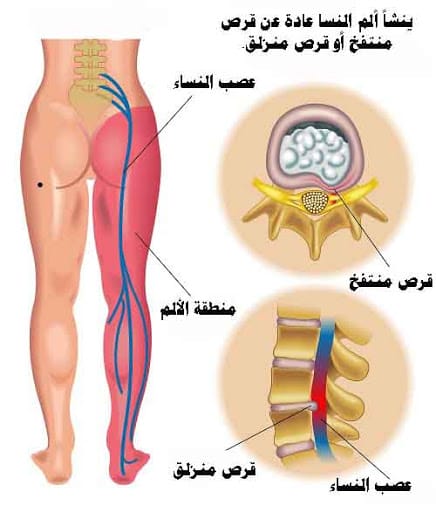 09914d39bc0b4493805c2b79251c85f2 | Egypt Chiropractic Center | Egypt Chiropractic Center