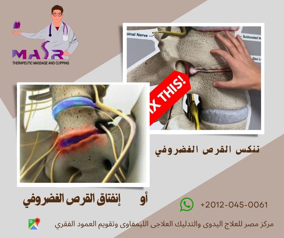 157e9f7cf6484b52a094d912db585465 | Egypt Chiropractic Center | Egypt Chiropractic Center