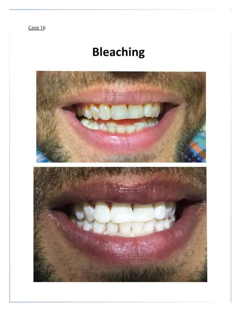 20 | Egypt Chiropractic Center | Egypt Chiropractic Center