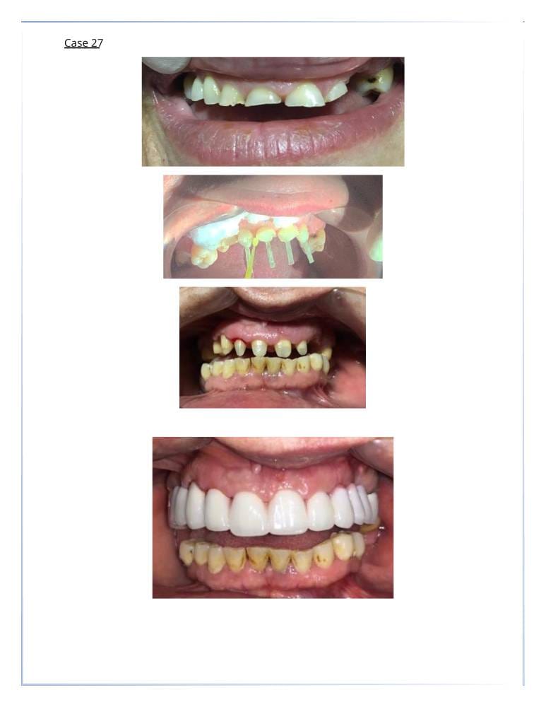 31 | Egypt Chiropractic Center | Egypt Chiropractic Center