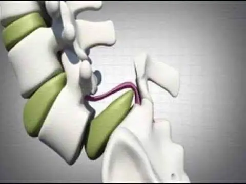 52817c61c11a45e889a6bc1792981946 | Egypt Chiropractic Center | Egypt Chiropractic Center