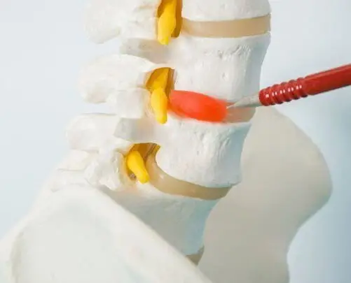 59a9c3856bca4774a21ab53009a06c7a | Egypt Chiropractic Center | Egypt Chiropractic Center