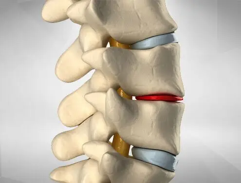 658eded84f68403791c4d6376df27bca | Egypt Chiropractic Center | Egypt Chiropractic Center