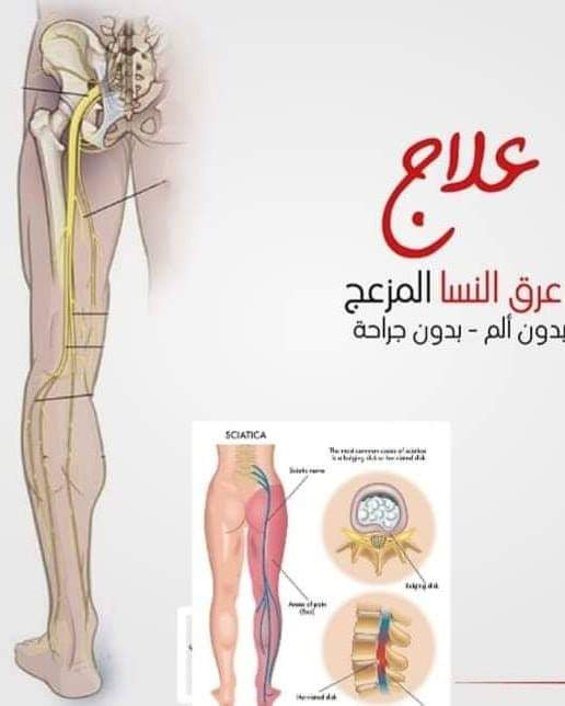 b10b25c9232b42179a76716ac55d8901 | Egypt Chiropractic Center | Egypt Chiropractic Center