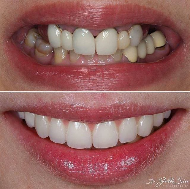 c6c95fffee124324822deabd8df4e34e | Egypt Chiropractic Center | Egypt Chiropractic Center