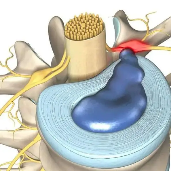 d39cb7c2d3644d7e967de081fe605344 | Egypt Chiropractic Center | Egypt Chiropractic Center