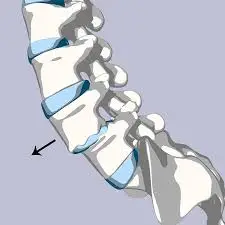 images | Egypt Chiropractic Center | Egypt Chiropractic Center