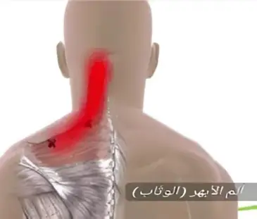 تصميم بدون عنوان | Egypt Chiropractic Center | Egypt Chiropractic Center