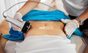 A woman undergoing a body fat reduction procedure in a clinical setting focused and attentive to the process